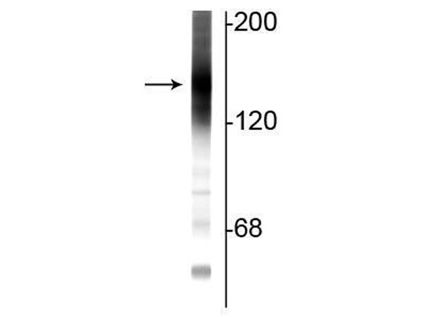 Western Blot of Anti-Adenylate Cyclase III